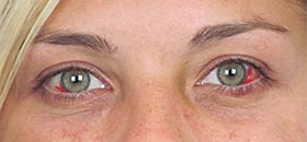 Complications Of Facial Surgery Before and After | Thomas Funcik MD