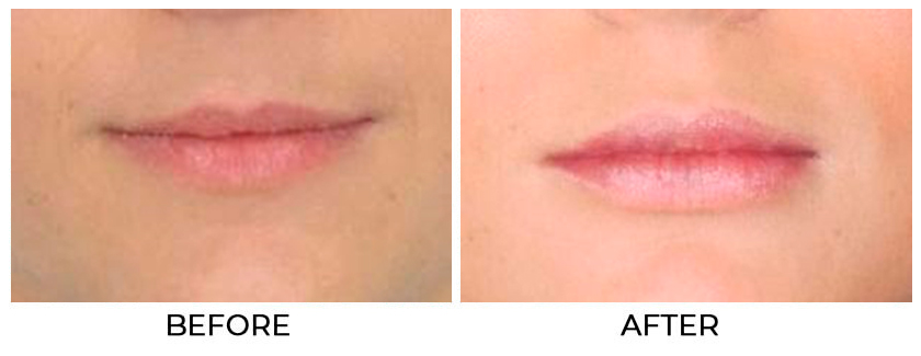 Before and After Treatment photo