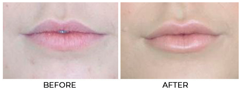 Before and After Treatment photo