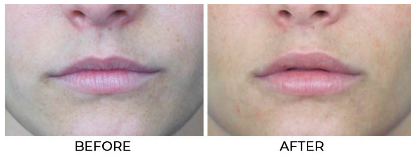 Before and After Treatment photo